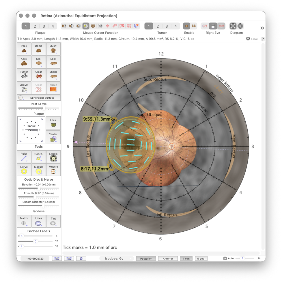 PosteriorProjection