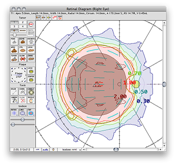 EP2029n-24Retina
