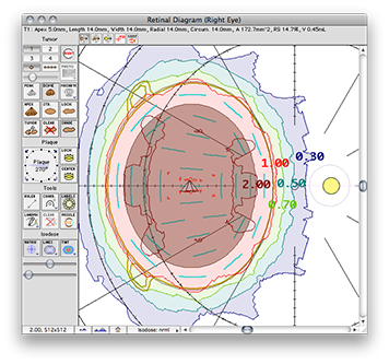 EP2031-24Retina