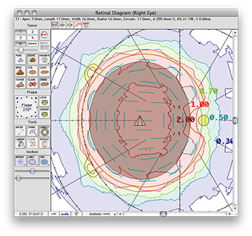 EP2440n-24Retina