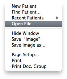 FileOpenFile
