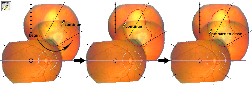 RDContourSequence