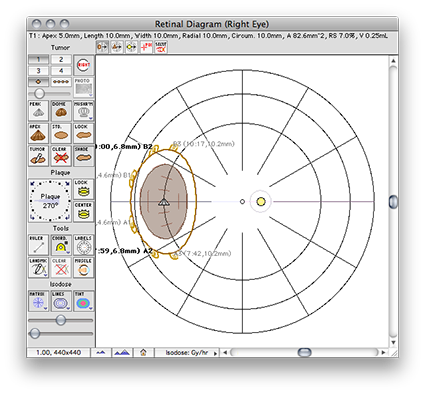 Diagram window