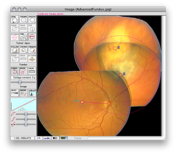DiagramImageWindowFundus
