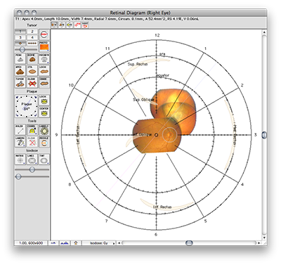 DiagramWithPhotoNoBackground