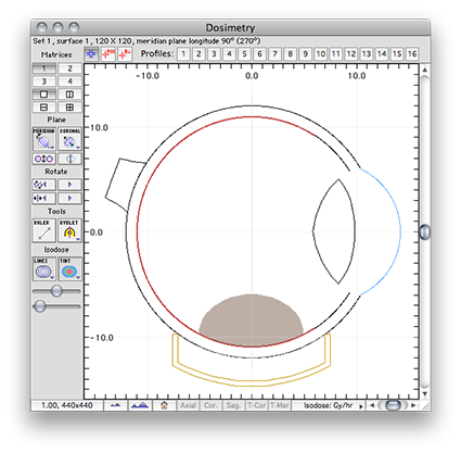 Dosimetry window