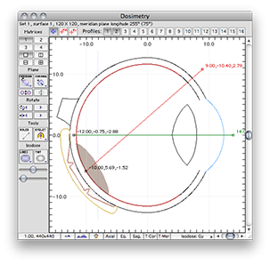 ProfilesDosimetry