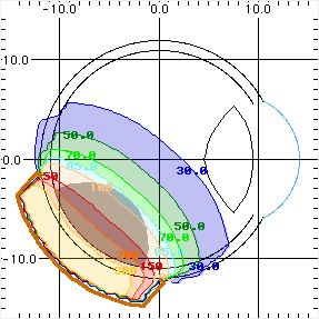 DoseMatrix