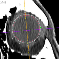 EquatorialTool
