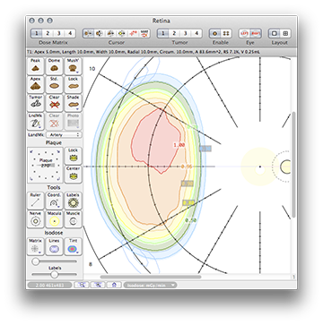 CCD404RetinaDose