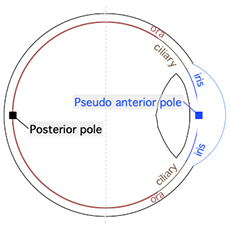 AnteriorPoleLocation