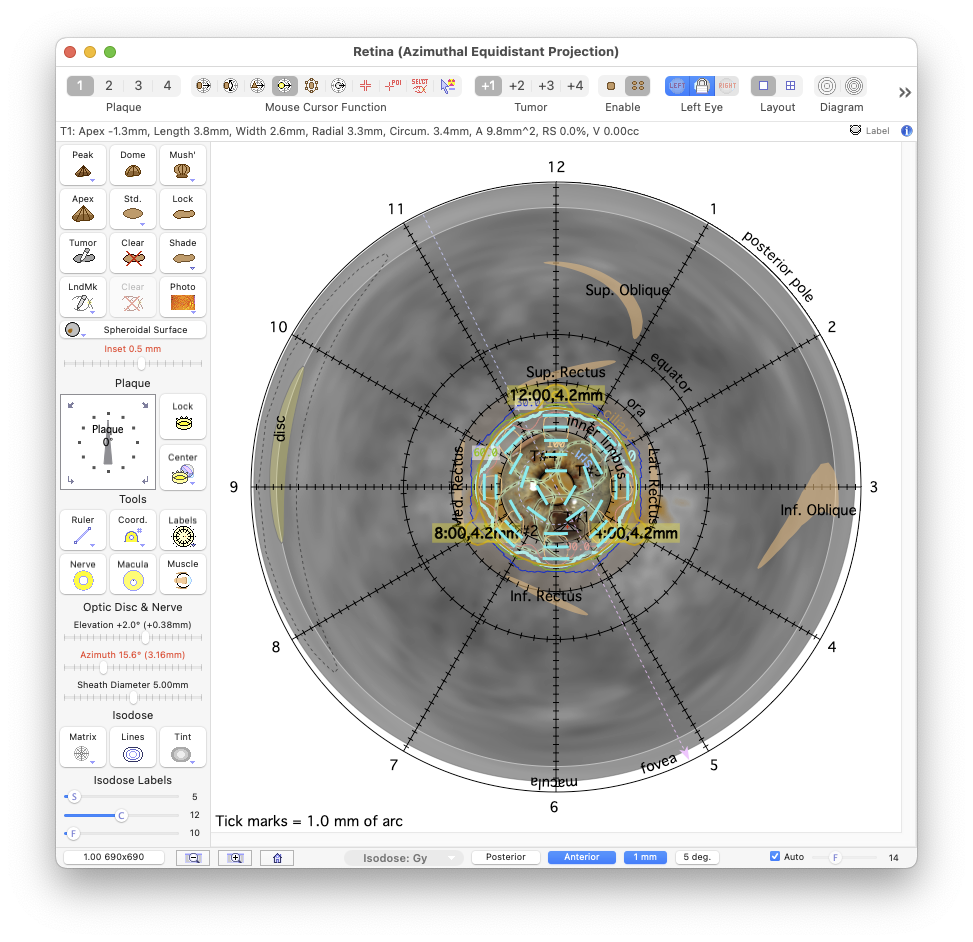 AnteriorProjection