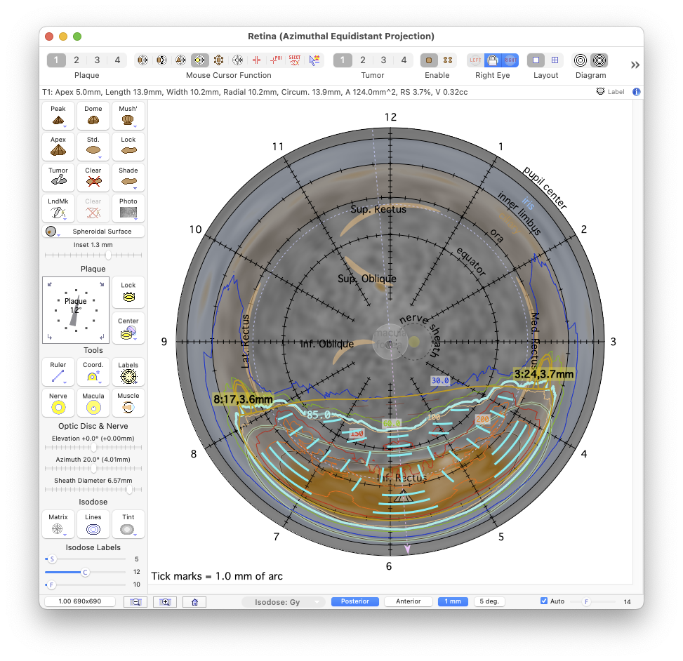 PosteriorProjectionIris