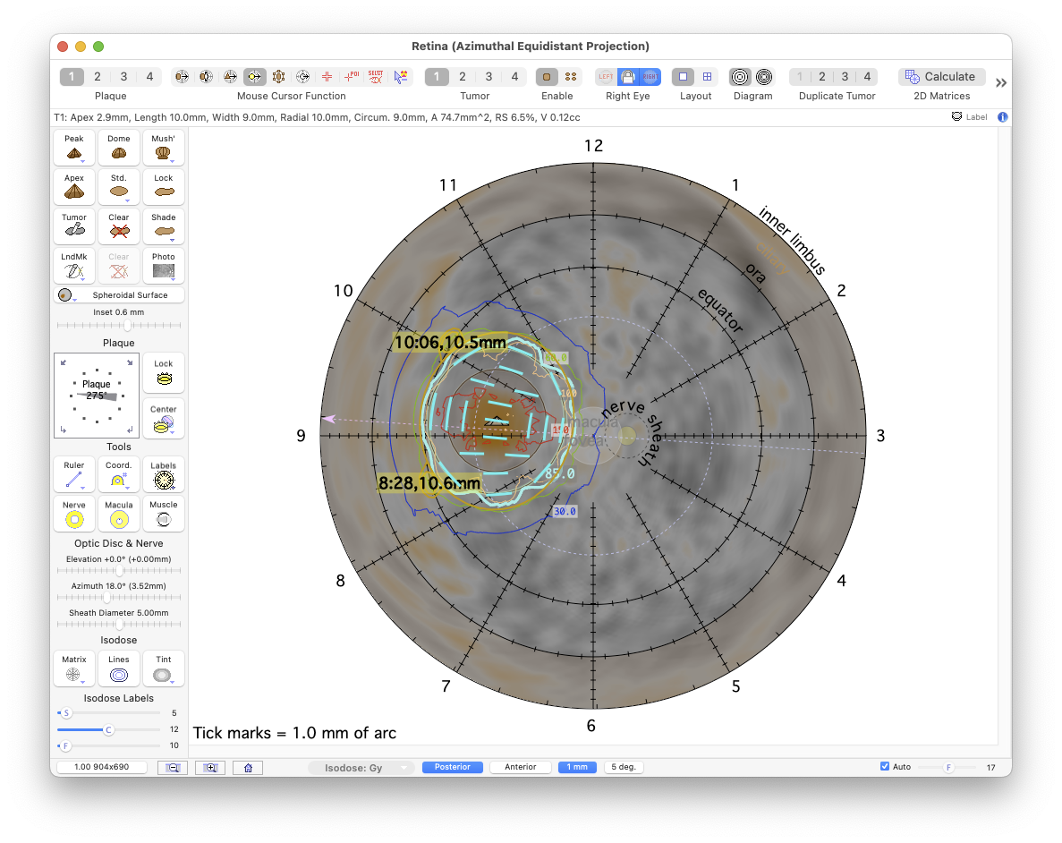 PosteriorProjectionSSR