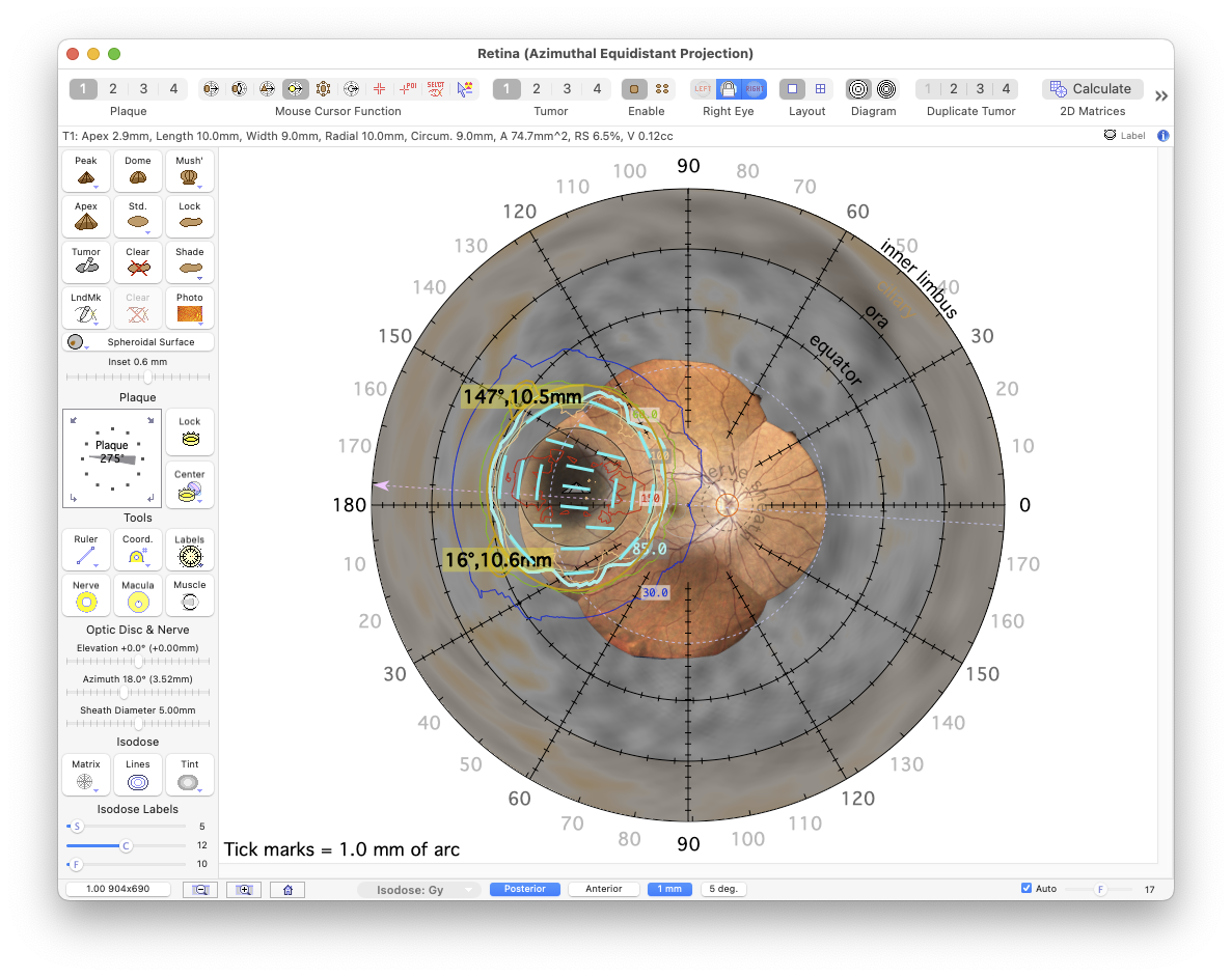 PosteriorProjectionToric