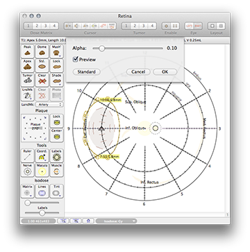 DiagramTumorShadingMenu