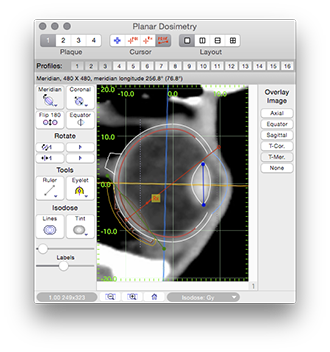 DoseProfileDosimetry