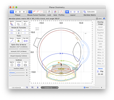 MeridianDosimetry