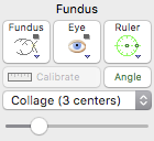 FundusGroupEye