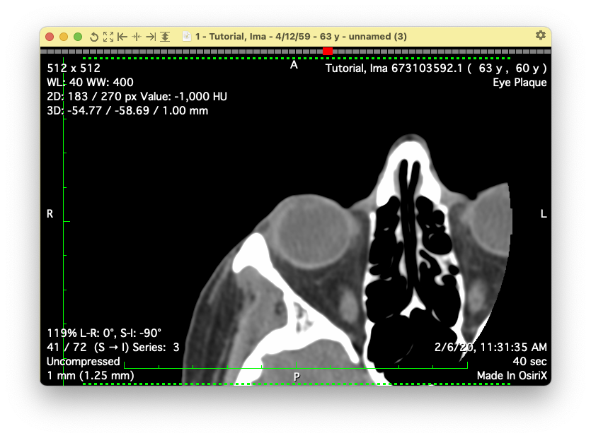 Osirix2Dviewer