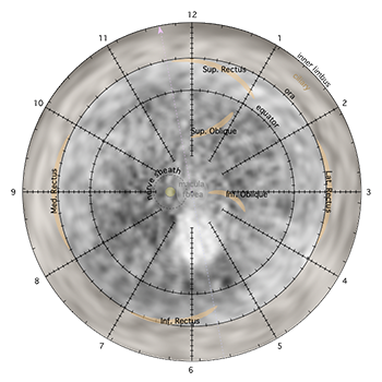 SpheroidalMonochrome