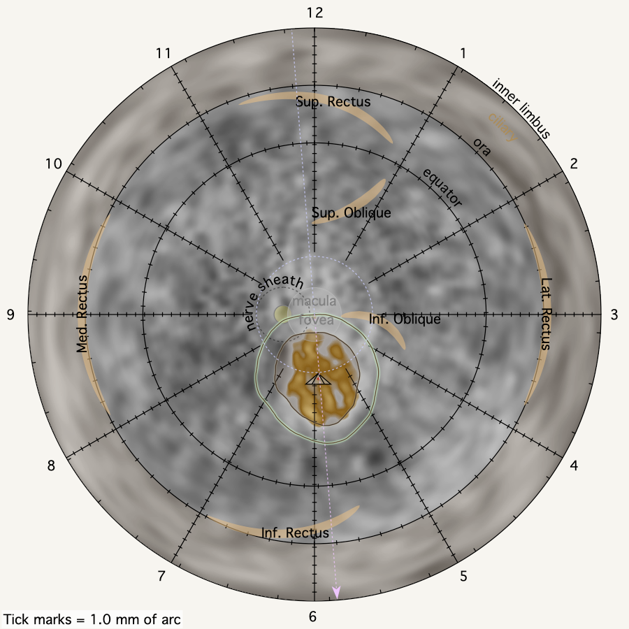 SpheroidalReconstruction