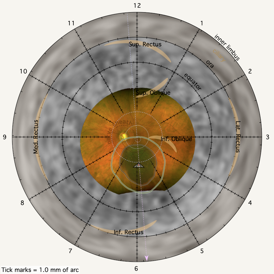 SpheroidalReconstructionFundus