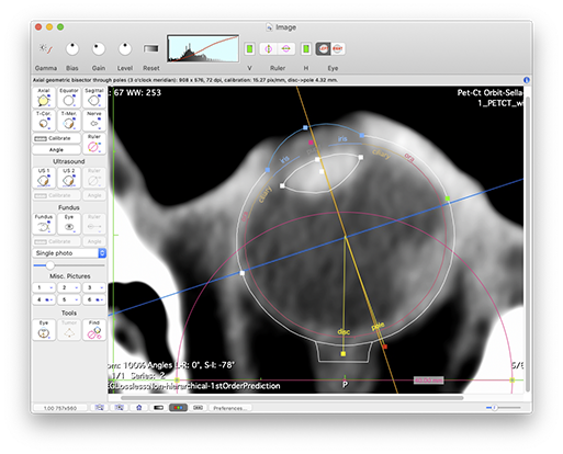 CalibrateCTEyeTool