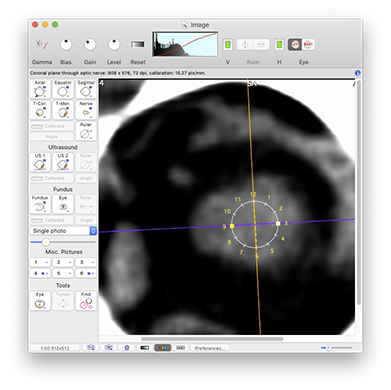 EyeToolNerve