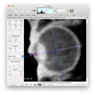 EyeToolSagittal