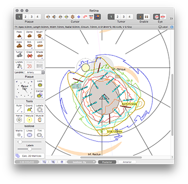 PlaqueLabelsRetina
