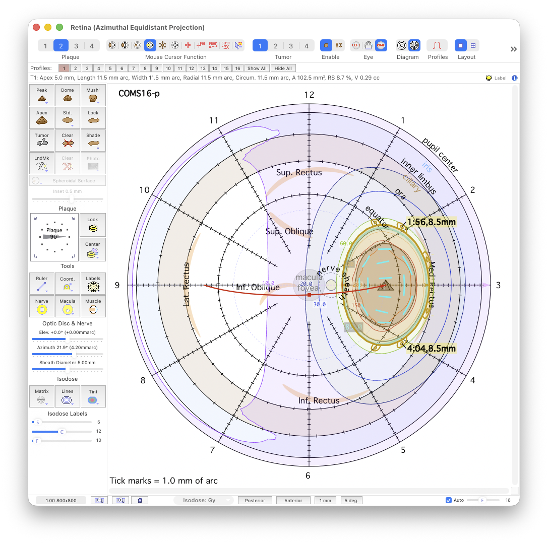 CircumferentialProfiles1