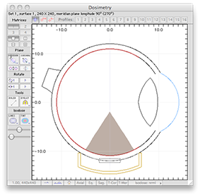 QA2012/Dosimetry