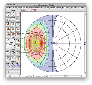 QA2012/RetinaLinear