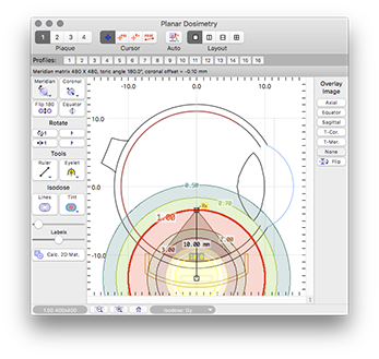 MeridianDosimetry