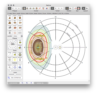 RetinaDosimetry