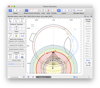 MeridianDosimetry