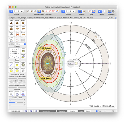 RetinaDosimetry