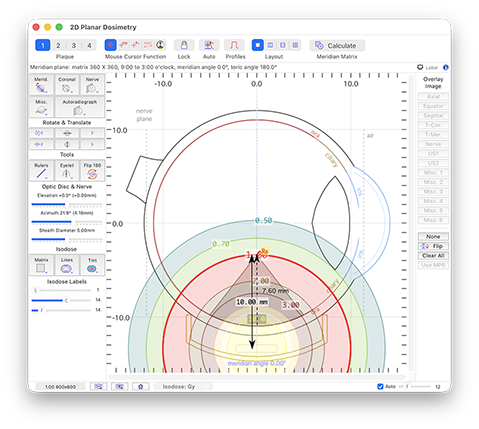 MeridianDosimetry