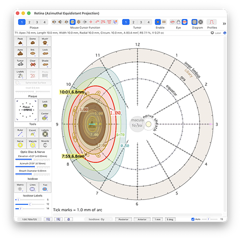 RetinaDosimetry