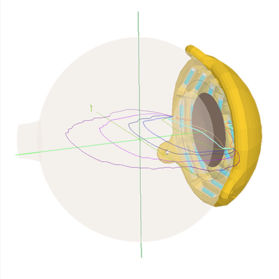 CiliarySetup