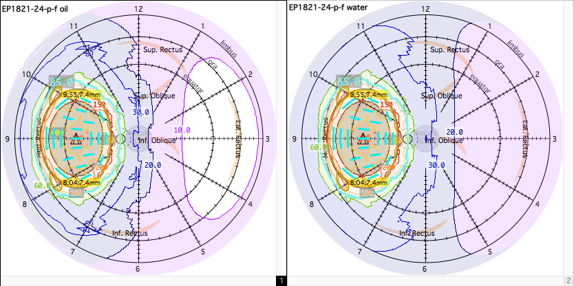 RetinalDiagrams