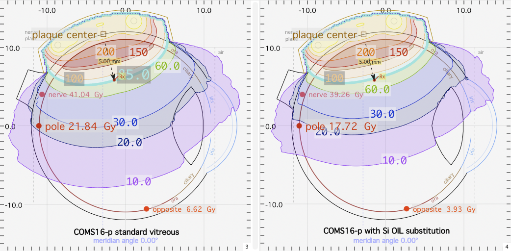 SP58meridians