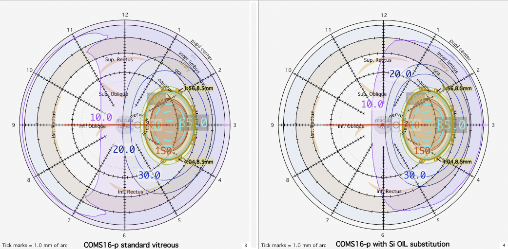 SP5retinas