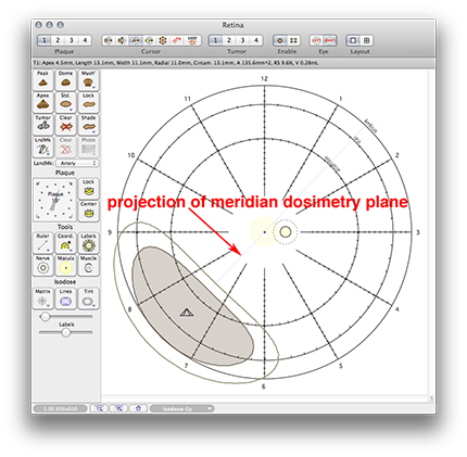 MeridianPlaneOnDiagram