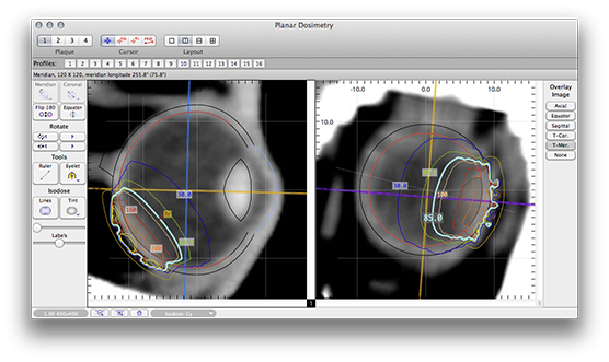 IT45PlanarDosimetry