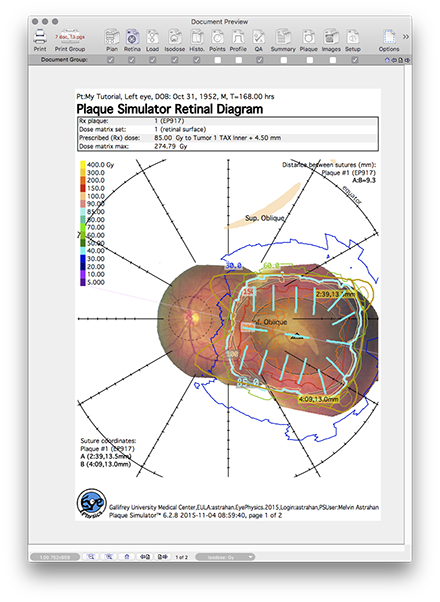 IT45RetinaPage1