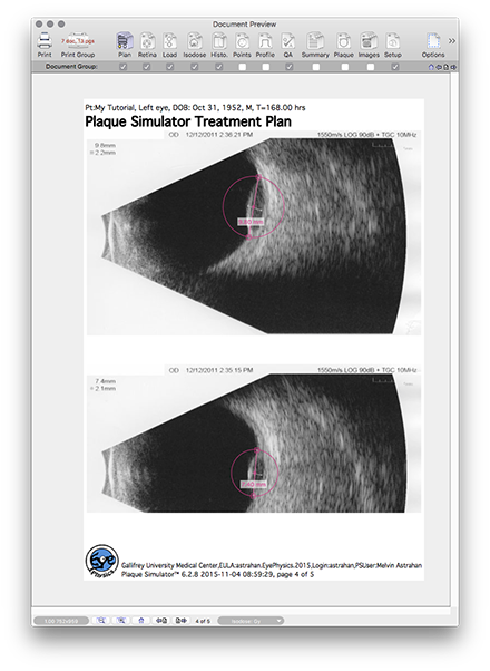 IT45TreatmentPlanPage4