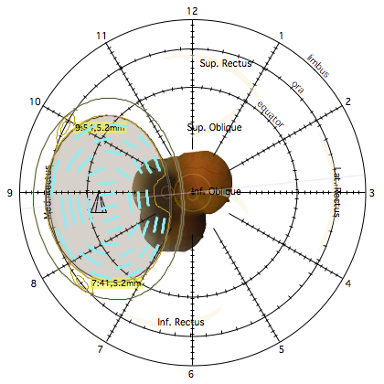 DiagramLoaded