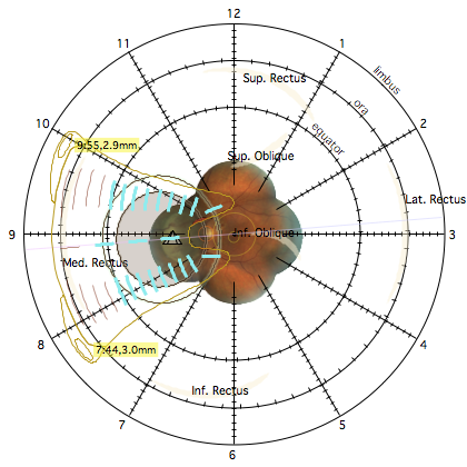 DiagramLoaded